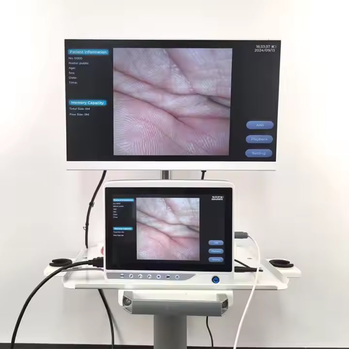 Wholesale Hot Selling Advanced Machine Gastroscope Colonoscope Veterinary Endoscope Camera Dog for Pet Hospital